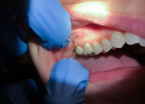 Best Emergency Treatment for Jaw Pain or Injury in Lake Montezuma, AZ